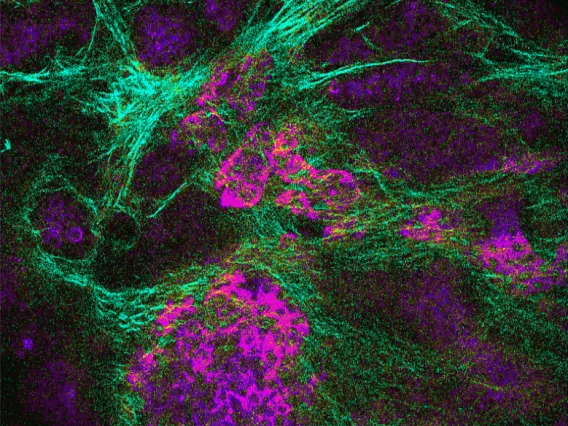 Cancer Cells Detected using Image Science