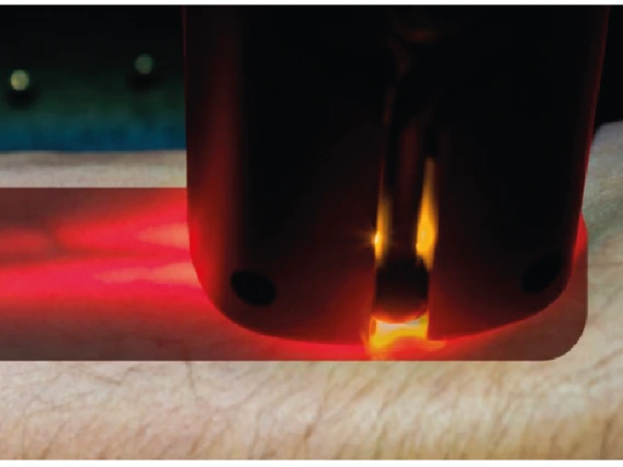 Photon density mode guiding examples: (a)  Numerical simulation of light transport through the human head, illuminated from the top. (b) Photograph of light guiding in human arm tendons.