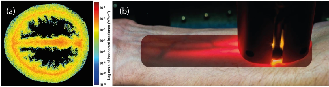 Photon density mode guiding examples: (a)  Numerical simulation of light transport through the human head, illuminated from the top. (b) Photograph of light guiding in human arm tendons.