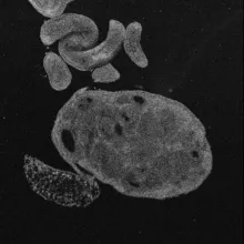 An optical coherence tomography image of an ovary.